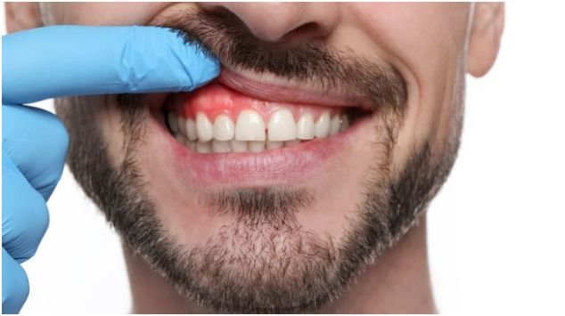 The Heart: How Gum Disease Impacts Cardiovascular Health