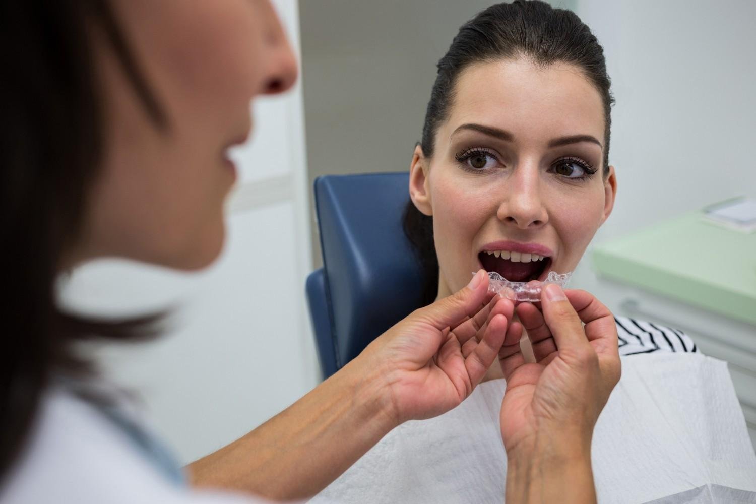 Getting Clear Aligners for Professionals in South Riding