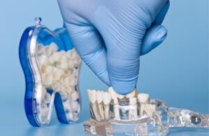 Best Dental Practices in Falls Church, VA for Families and Individuals Who Value Their Wellbeing