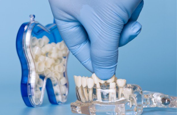 Best Dental Practices in Falls Church, VA for Families and Individuals Who Value Their Wellbeing